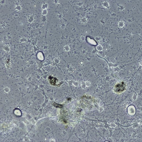 microscopic view of algae